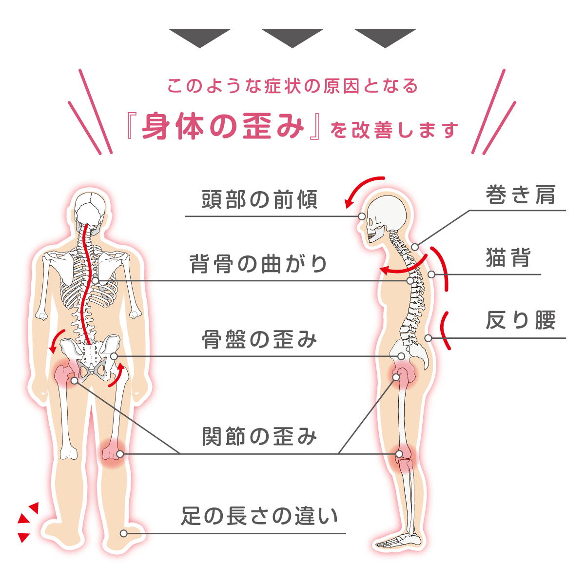 諸症状の原因となる身体の歪み