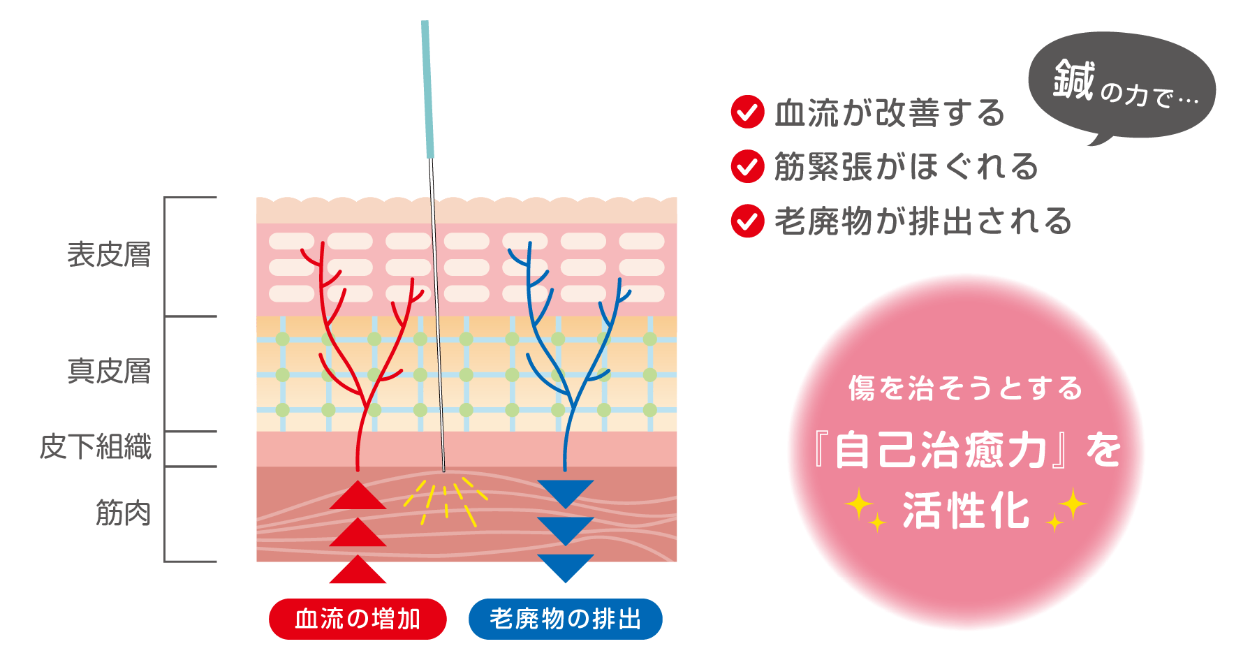 鍼治療のメカニズム