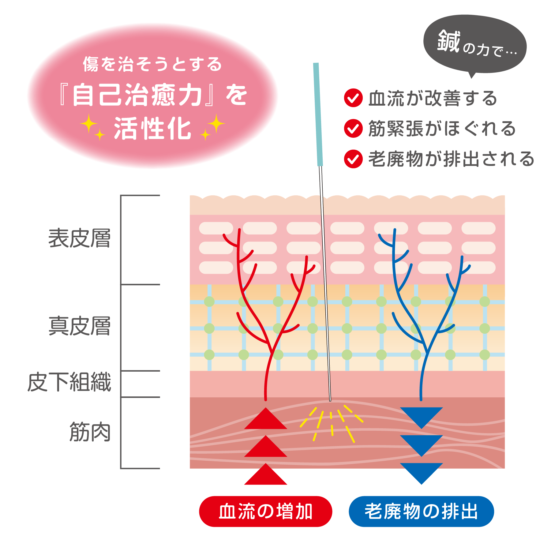 鍼治療のメカニズム