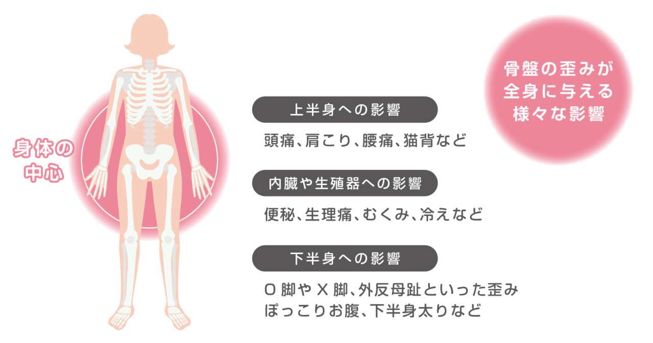 骨盤の歪みが全身に与える影響