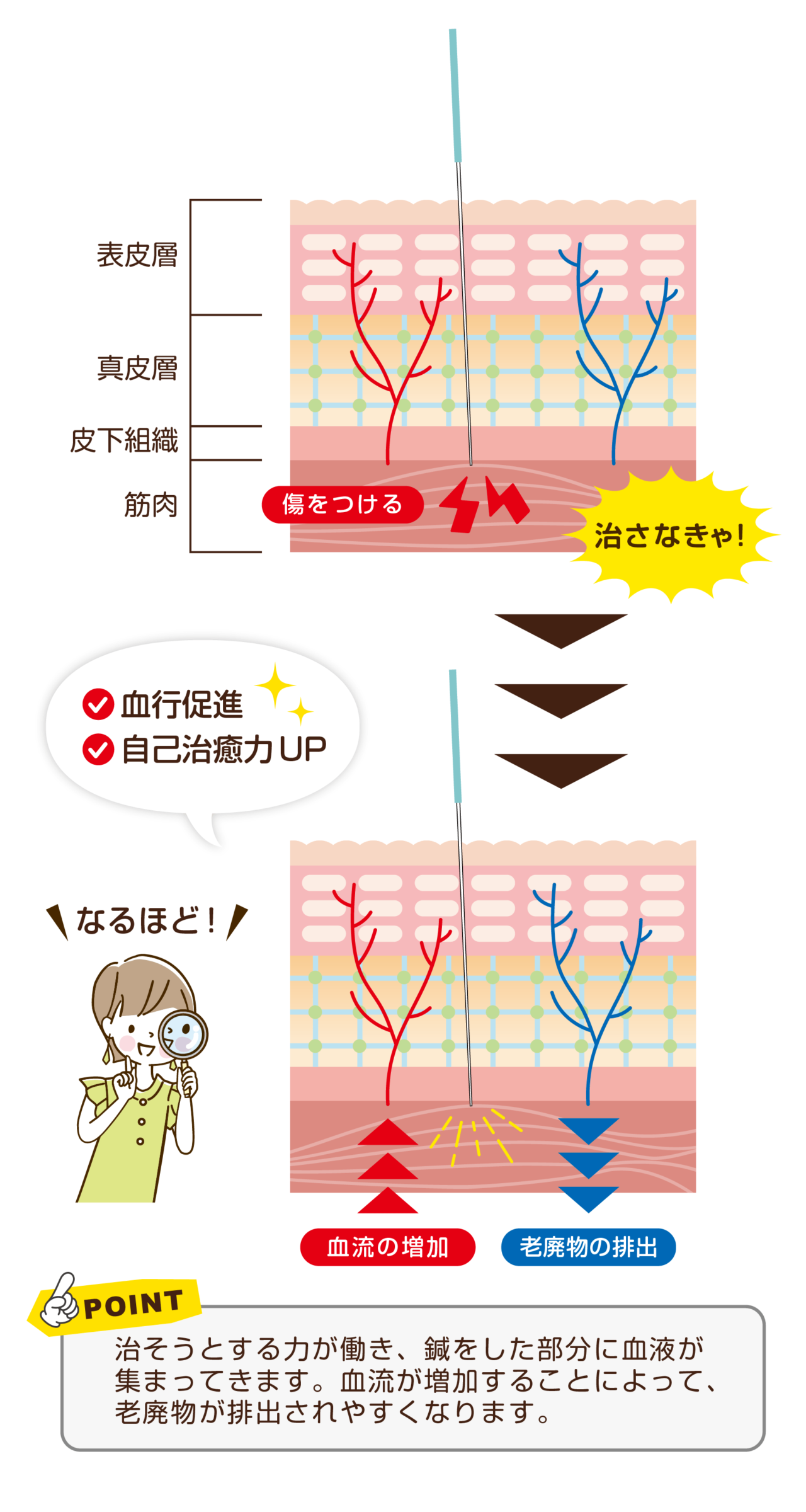 筋繊維に傷をつけると自己治癒力で血流が増加します。すると老廃物も排出されやすくなります。