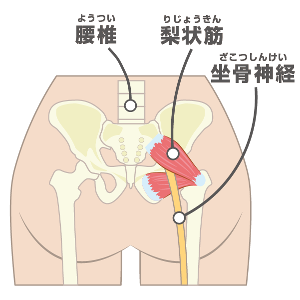 梨状筋と坐骨神経のイラスト