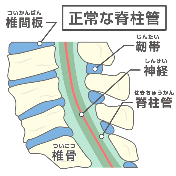 正常な脊柱管のイラスト