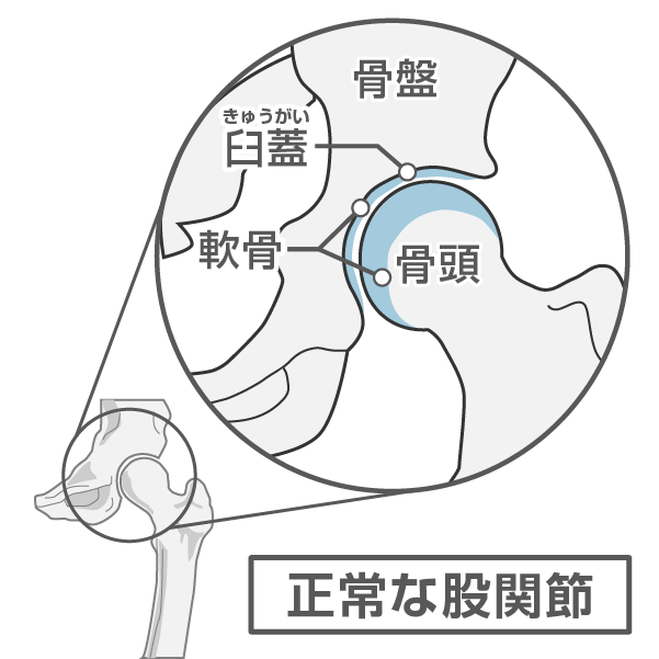 正常な股関節のイラスト