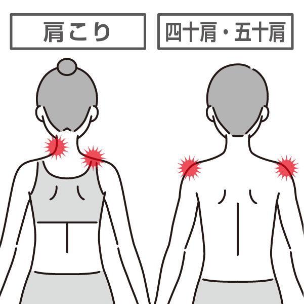 四十肩や五十肩と肩こりの違い