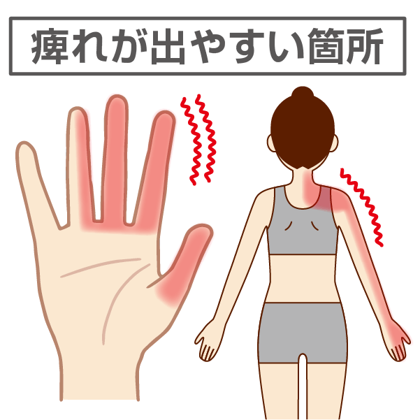 手や腕の痺れが出やすい箇所