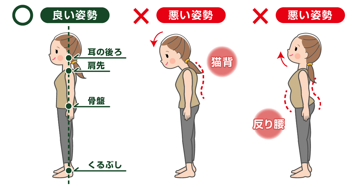 立った状態での正しい姿勢と悪い姿勢